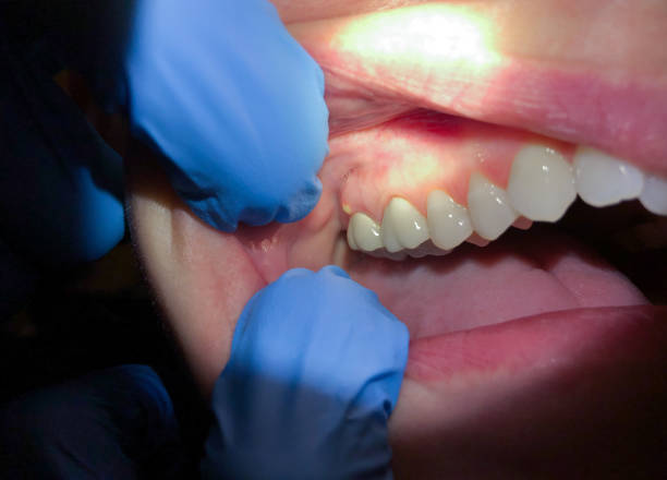 Best Emergency Treatment for Toothache in Riverside, MO