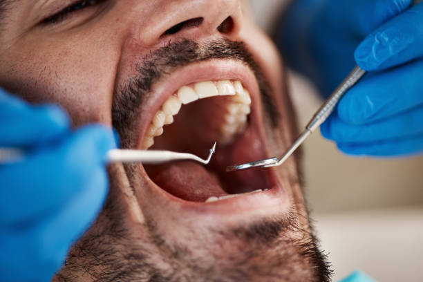Best Weekend Emergency Dentist in Riverside, MO